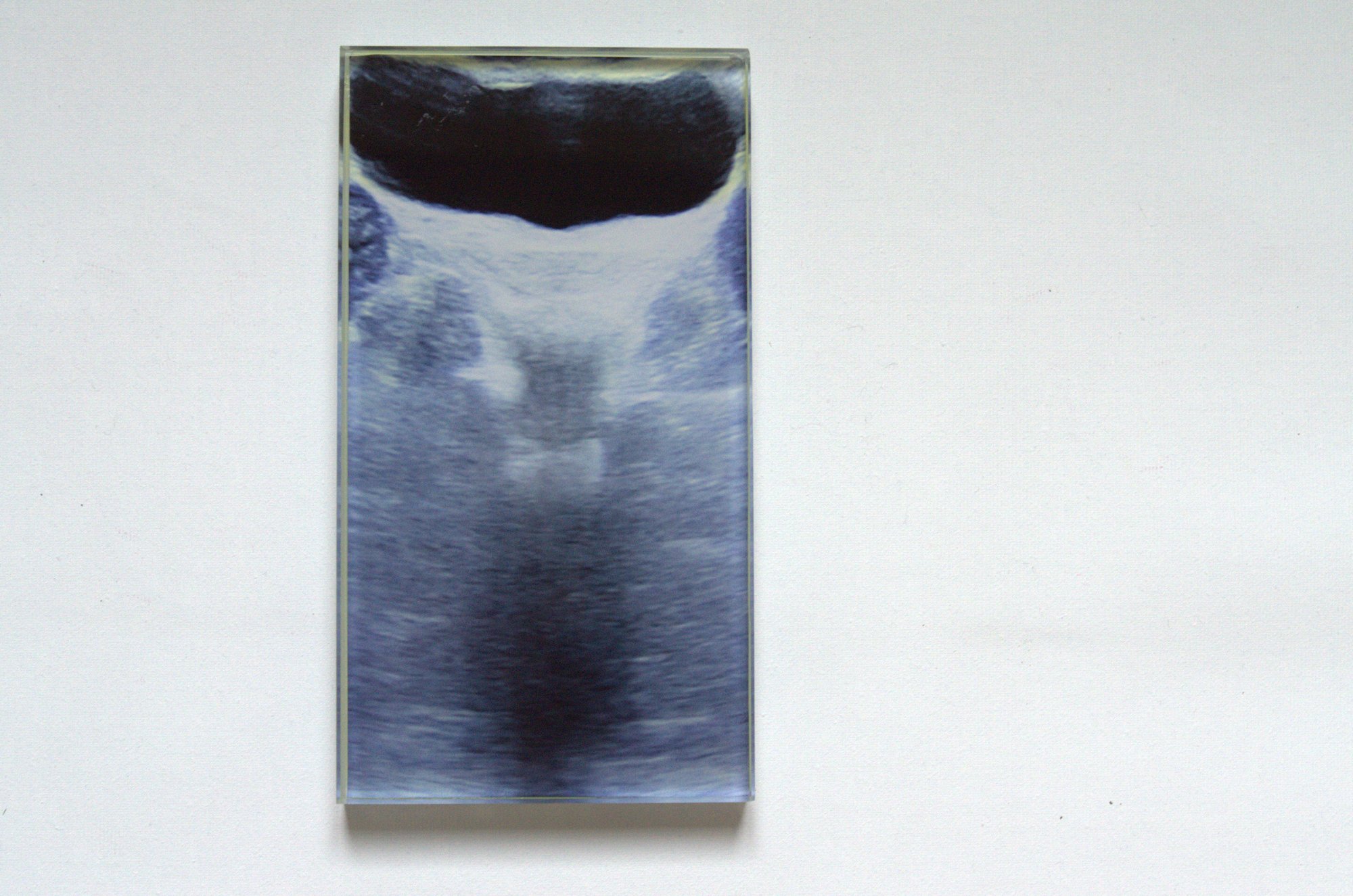 Vetro N° 03 — Ecografia