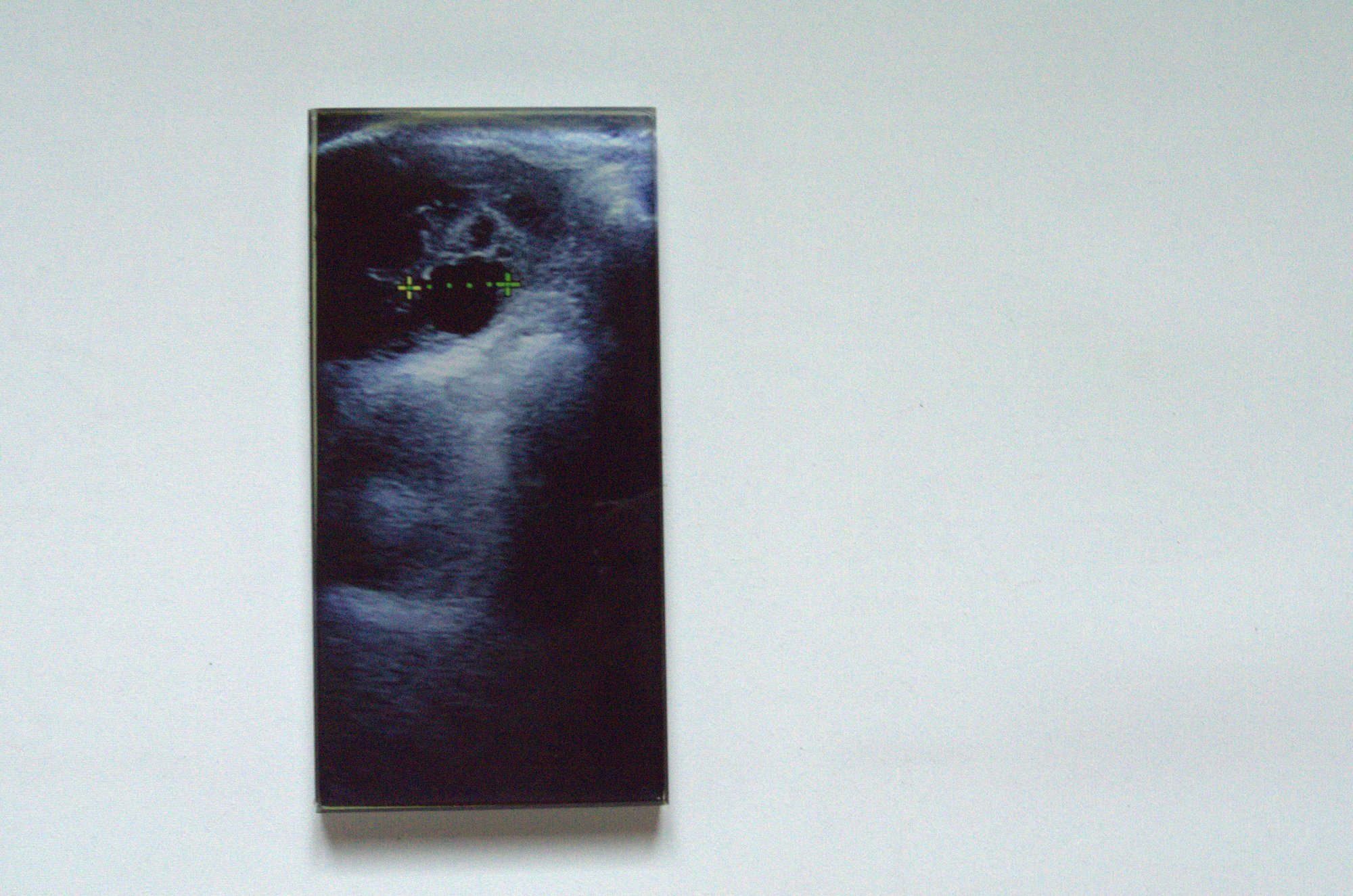 Vetro N° 05 — Ecografia
