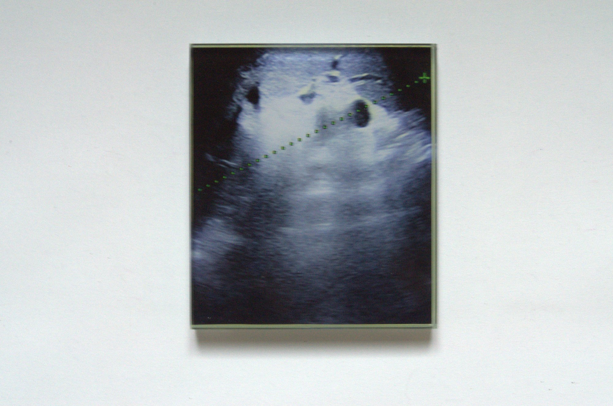 Vetro N° 06 — Ecografia